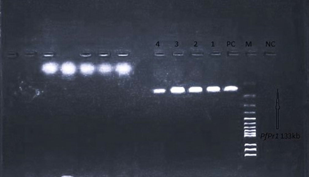 Gel picture showing detection of Klebsiella pneumoniae using the species-specific gene PfPr1. Lane 1: Negative control, Lane 2: Marker, Lane 3: Positive control, Lanes 4-6: Sample results.